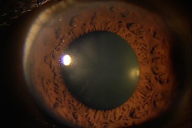 dg37157pic15-1 dg37157pic15-1