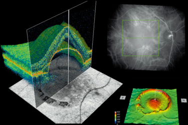 Диагностическое обследование структур глаза